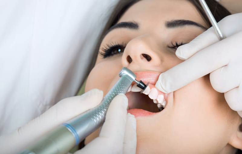 Dentista realizando una limpieza dental