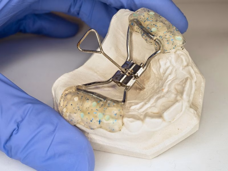 Ortodoncia Interceptiva